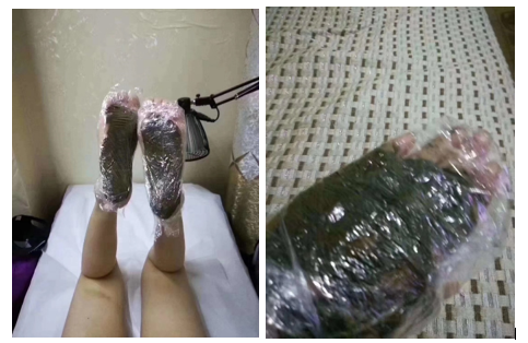 Traditional Foot Wrapping